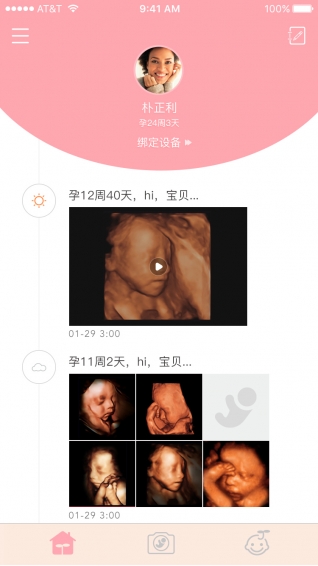 胎儿相机ios版